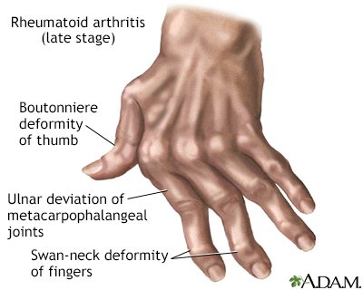 Arthritis and Rheumatology Pic