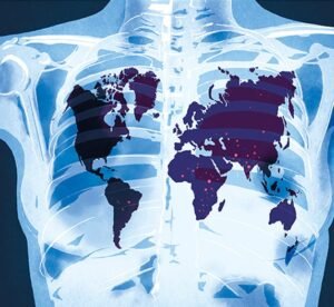 Lancet Infectious Diseases journal logo