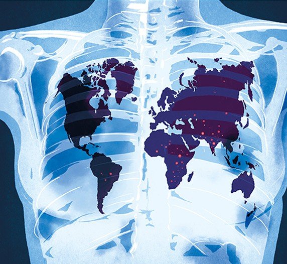 Lancet Infectious Diseases Photo