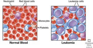 Leukemia journal logo