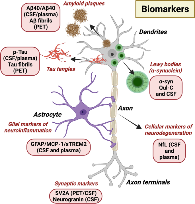 Molecular Neurodegeneration Photo